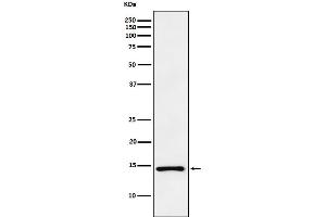 Western blot analysis of ANP expression in PC3 cell lysate.