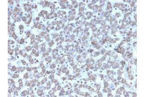 Immunohistochemistry (IHC) image for anti-Prohibitin (PHB) (AA 167-261) antibody (ABIN6940306)