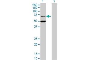 Western Blot analysis of ZNF182 expression in transfected 293T cell line by ZNF182 MaxPab polyclonal antibody. (ZNF182 Antikörper  (AA 1-620))