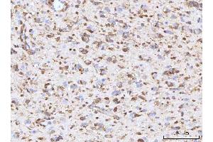 IHC analysis of RBP1 using anti-RBP1 antibody (ABIN7599586). (RBP1 Antikörper  (AA 10-135))