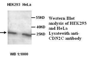Image no. 1 for anti-Cyclin-Dependent Kinase Inhibitor 2C (p18, Inhibits CDK4) (CDKN2C) antibody (ABIN1575551) (CDKN2C Antikörper)