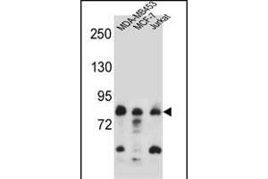 AFG3L2 Antibody (N-term) (ABIN657143 and ABIN2846279) western blot analysis in MDA-M,MCF-7,Jurkat cell line lysates (35 μg/lane). (AFG3L2 Antikörper  (N-Term))