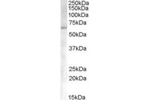Image no. 1 for anti-Activin Receptor Type I (ACRV1) (Internal Region) antibody (ABIN238620)
