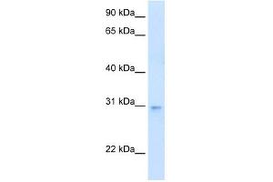 WB Suggested Anti-LDB3 Antibody Titration:  0.