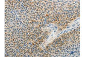 Immunohistochemistry (IHC) image for anti-ArfGAP with GTPase Domain, Ankyrin Repeat and PH Domain 1 (AGAP1) antibody (ABIN7189711)