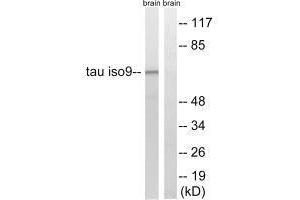 Western blot analysis of extracts from rat brain cells, using Tau (Ab-534/217) antibody. (MAPT Antikörper  (Thr217, Thr534))