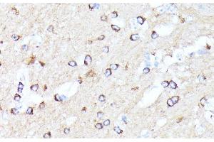 Immunohistochemistry (Paraffin-embedded Sections) (IHC (p)) image for anti-Coiled-Coil Domain Containing 6 (CCDC6) antibody (ABIN7258894)