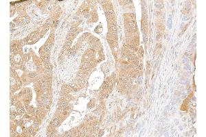 Immunohistochemistry (IHC) image for anti-NF-KappaB2 (/p52) (AA 1-50) antibody (ABIN7795782)