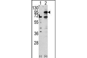 Western blot analysis of CPT1B (arrow) using rabbit polyclonal CPT1B Antibody (C-term) (ABIN389106 and ABIN2839296). (CPT1B Antikörper  (C-Term))