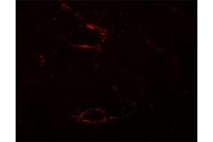 Immunofluorescencent staining of mouse skeletal muscle cells with SYNPO2L polyclonal antibody  at 5 ug/mL. (SYNPO2L Antikörper  (N-Term))