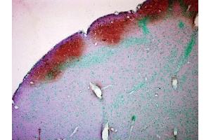 Immunohistochemistry analysis using Mouse Anti-CaMKII Monoclonal Antibody, Clone 22B1 . (CAMKII gamma Antikörper  (Atto 390))
