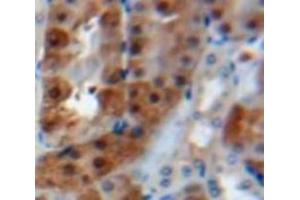 Used in DAB staining on fromalin fixed paraffin-embedded Kidney tissue (Calreticulin Antikörper  (AA 18-193))