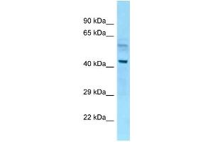 WB Suggested Anti-Nap1l4 Antibody Titration: 1. (NAP1L4 Antikörper  (N-Term))