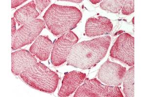 Human Skeletal Muscle: Formalin-Fixed, Paraffin-Embedded (FFPE) (SEMA4D/CD100 Antikörper  (AA 812-862))