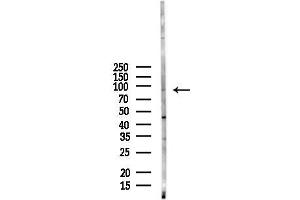 anti-A Kinase (PRKA) Anchor Protein 4 (AKAP4) (N-Term) antibody