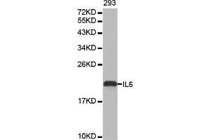 Western blot analysis of extracts of 293 cell line, using IL6 antibody. (IL-6 Antikörper)