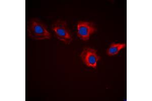Immunofluorescent analysis of MARK3 staining in HeLa cells.