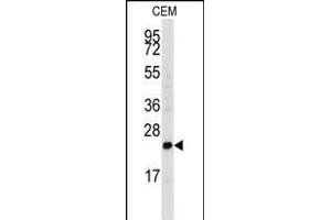 Western blot analysis of anti-FGF4 Antibody (C-term) (ABIN392776 and ABIN2842218) in CEM cell line lysates (35 μg/lane). (FGF4 Antikörper  (C-Term))