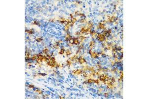 Immunohistochemistry of paraffin-embedded rat spleen using CD3D antibody (ABIN5970580) at dilution of 1/200 (40x lens). (CD3D Antikörper)