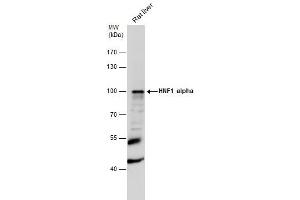 Western Blotting (WB) image for anti-HNF1 Homeobox A (HNF1A) antibody (ABIN2856932)