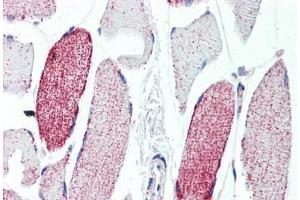 Human Skeletal Muscle (formalin-fixed, paraffin-embedded) stained with ACO2 antibody ABIN462115 followed by biotinylated goat anti-rabbit IgG secondary antibody ABIN481713, alkaline phosphatase-streptavidin and chromogen. (ACO2 Antikörper  (AA 438-467))