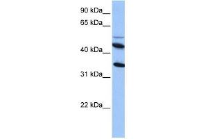 IL13RA2 antibody used at 1 ug/ml to detect target protein. (IL13RA2 Antikörper  (Middle Region))