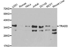 Western blot analysis of extracts of various cell lines, using TRADD antibody. (TRADD Antikörper)