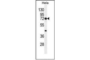 Western blot analysis of Cyclooxygenase 2 Antibody (Center) in Hela cell line lysates (35ug/lane).