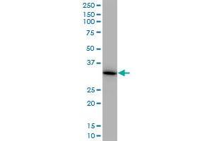 MDH1 monoclonal antibody (M01), clone 2B11-B7.