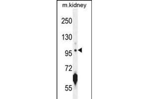 ATPGD1 Antibody (N-term) (ABIN654537 and ABIN2844255) western blot analysis in mouse kidney tissue lysates (35 μg/lane). (CARNS1 Antikörper  (N-Term))