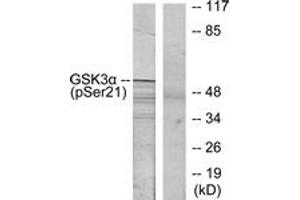 Western blot analysis of extracts from ovary cancer, using GSK3 alpha (Phospho-Ser21) Antibody.