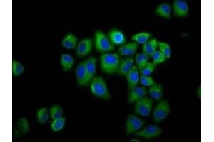Immunofluorescence staining of Hela cells with ABIN7154190 at 1:200, counter-stained with DAPI. (GLRB Antikörper  (AA 355-472))