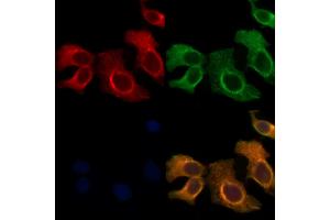 ABIN6265851 and ABIN6278192 staining Hela cells by IF/ICC. (UBE2L6 Antikörper  (C-Term))