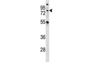 MST1 antibody western blot analysis in NCI-H460 lysate.