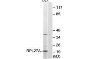 Western blot analysis of extracts from COLO cells, using RPL27A Antibody. (RPL27A Antikörper  (AA 99-148))