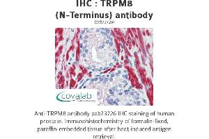 Image no. 2 for anti-Transient Receptor Potential Cation Channel, Subfamily M, Member 8 (TRPM8) (Cytoplasmic Domain), (N-Term) antibody (ABIN1740398) (TRPM8 Antikörper  (Cytoplasmic Domain, N-Term))