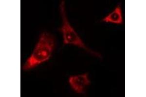 ABIN6275680 staining Hela cells by IF/ICC. (WIPF1 Antikörper  (C-Term))
