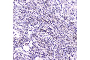 IHC analysis of CES1 using anti-CES1 antibody . (CES1 Antikörper  (AA 99-206))