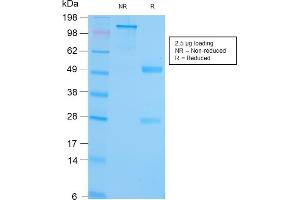 SDS-PAGE Analysis Purified GRP94 Recombinant Rabbit Monoclonal (HSP90B1/3168R). (Rekombinanter GRP94 Antikörper)