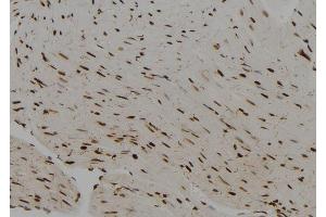 ABIN6279641 at 1/100 staining Rat heart tissue by IHC-P. (PRRX2 Antikörper  (Internal Region))