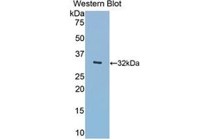 Detection of Recombinant Hpt,Hu using Polyclonal Antibody to Meningioma Expressed Antigen 5 (MGEA5) (MGEA5 Antikörper  (AA 319-450))