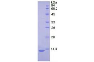 SDS-PAGE of Protein Standard from the Kit  (Highly purified E. (PLAT ELISA Kit)
