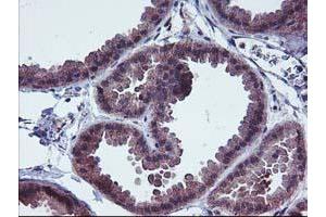 Immunohistochemical staining of paraffin-embedded Human breast tissue using anti-FGFR2 mouse monoclonal antibody. (FGFR2 Antikörper)