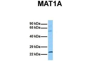 Host:  Rabbit  Target Name:  MAT1A  Sample Tissue:  Human Ovary Tumor  Antibody Dilution:  1. (MAT1A Antikörper  (C-Term))