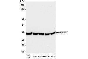 anti-Protein Phosphatase 6, Catalytic Subunit (PPP6C) (C-Term) antibody