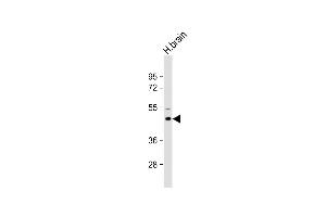 Anti-M1 Antibody (Center) at 1:2000 dilution + Human brain lysate Lysates/proteins at 20 μg per lane.