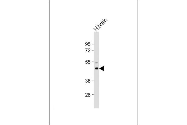 AP1M1 antibody  (AA 199-227)