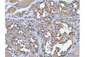 IHC analysis of Glutathione Reductase using anti-Glutathione Reductase antibody (ABIN5693151).