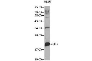 Western blot analysis of extracts of HL-60 cells, using BID Antibody. (BID Antikörper  (AA 1-130))