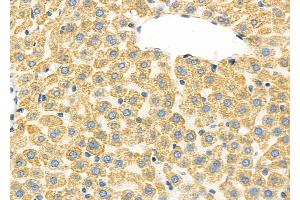 ABIN6260778 and ABIN6277329 at 1/100 staining Rat liver tissue by IHC-P. (CFHR1 Antikörper  (C-Term))